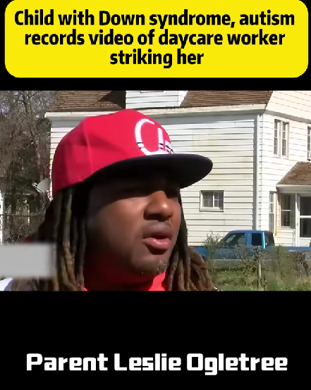 Child With Down Syndrome & Autism Secretly Records Daycare Worker Striking Her — Heartbroken Parent Speaks Out