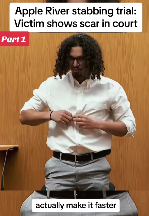 “Courtroom Gasps as Victim Lifts Shirt to Show Massive Scar at Stbing Trial — Part 1”