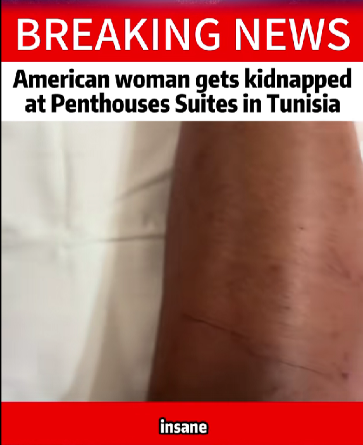 “BREAKING: Tourist’s Nightmare Escape From Luxury Tunisian Suites Leaves Investigators Stunned!”