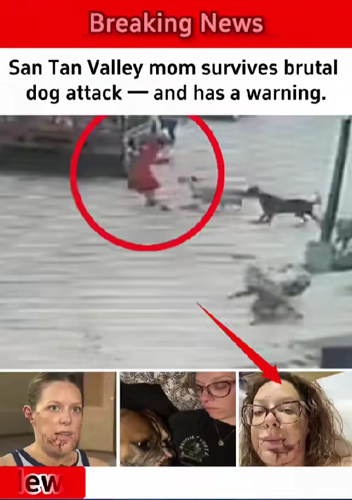 San Tan Valley Mom Survives Brutal Dog Att*ck — and Issues a Chilling Warning to Others